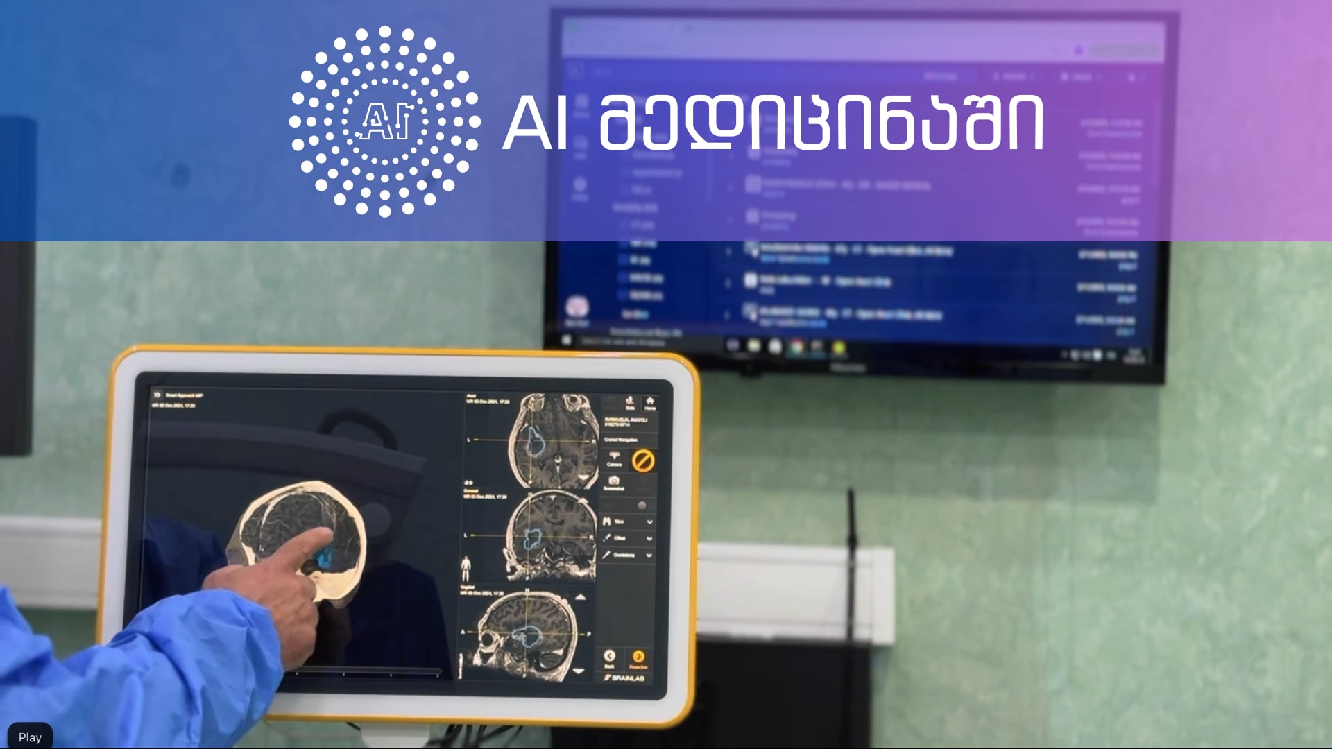AI რევოლუცია ჯანდაცვის სფეროში