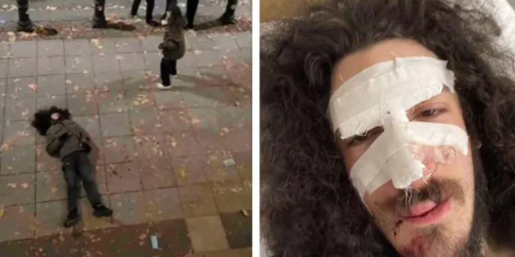 “ვყვიროდი, რომ არ დაერტყათ, მაგრამ მაინც მირტყამდნენ. გავიდა უკვე ერთი წელი და რიგითი რობოკოპიც კი არ არის დაკითხული” – ზვიად მაისაშვილი